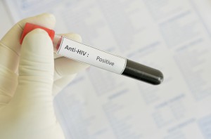 Vad innebär hiv och aids 2