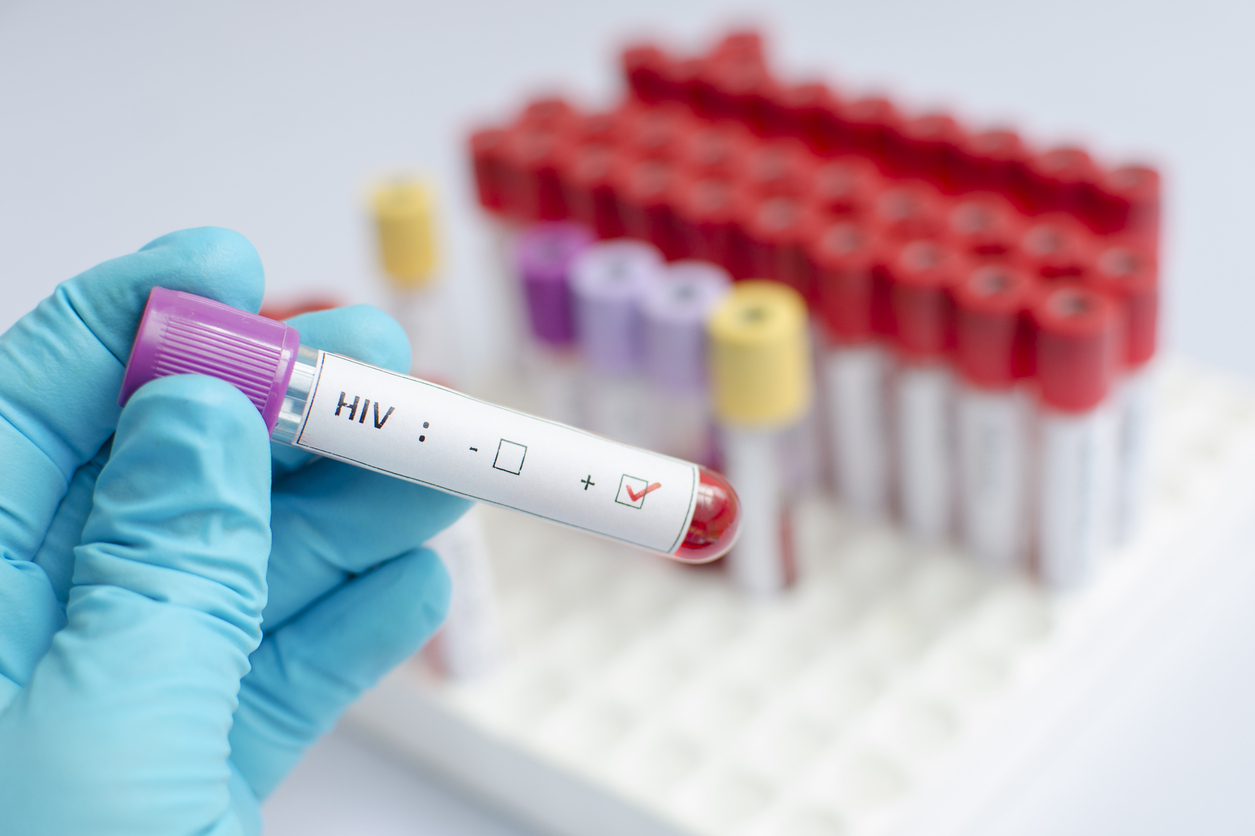 Ett blodprov för att upptäcka HIV-smitta
